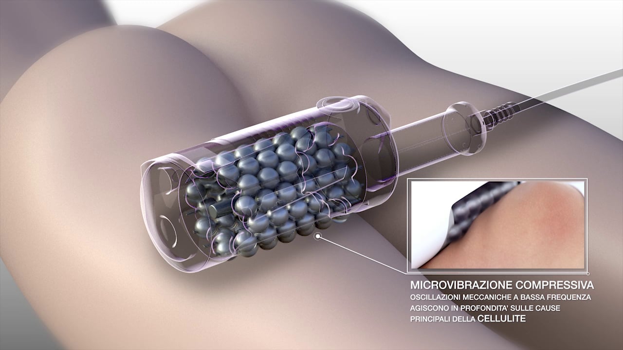 Endosphere Micro vibration system
