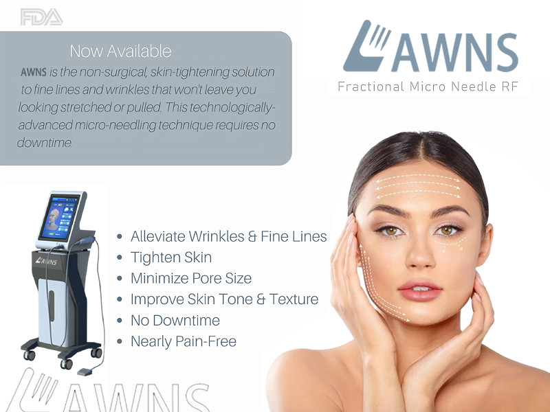 FDA cleared Sincoheren Fractional Mirconeeding RF